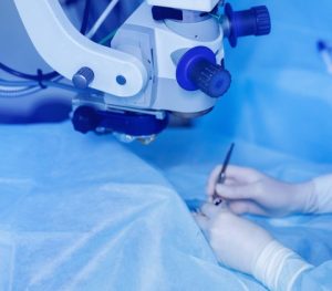 Cirurgia refrativa personalizada para astigmatismo - Dr Visão