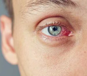 Tratamento da retinopatia diabética - Dr Visão